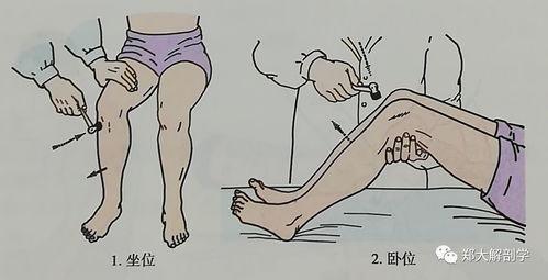 膝反射视频,神经传导与生理反应的直观展示