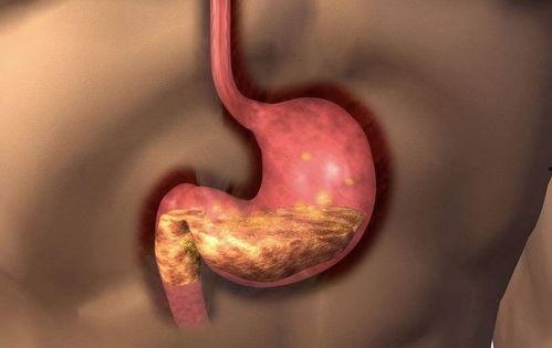 胃炎可以吃黑瓜吗小孩,黑瓜适宜与否解析