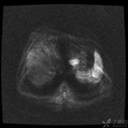腹部体格检查视频,关键步骤与技巧详解