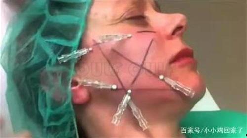 大v线雕视频,揭秘面部轮廓重塑的神奇魔法