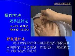 针灸手法入门视频,视频教程精华概述